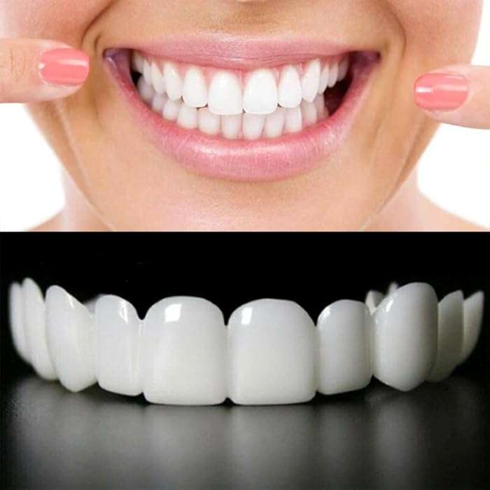 Snap On Smile Braces Teeth Kit - Link Lift Shop