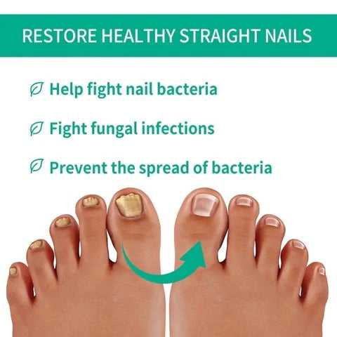 Nail Fungus Serum (MADE IN USA) - Link Lift Shop