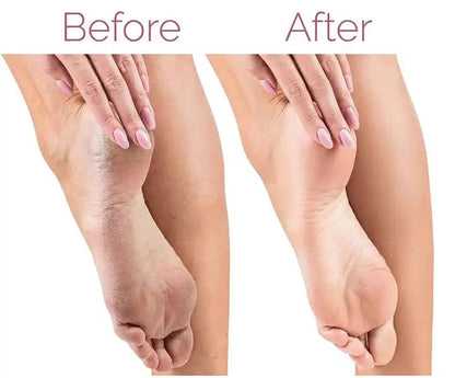Rechargeable Flawless Electric Foot Callus and dead body Remover - Link Lift Shop