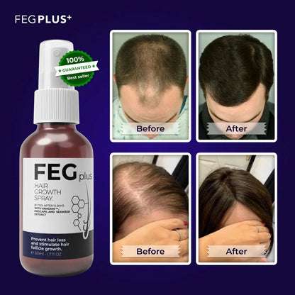 FEG Plus Beard & Hair Growth Serum Spray | 60 ML - Link Lift Shop