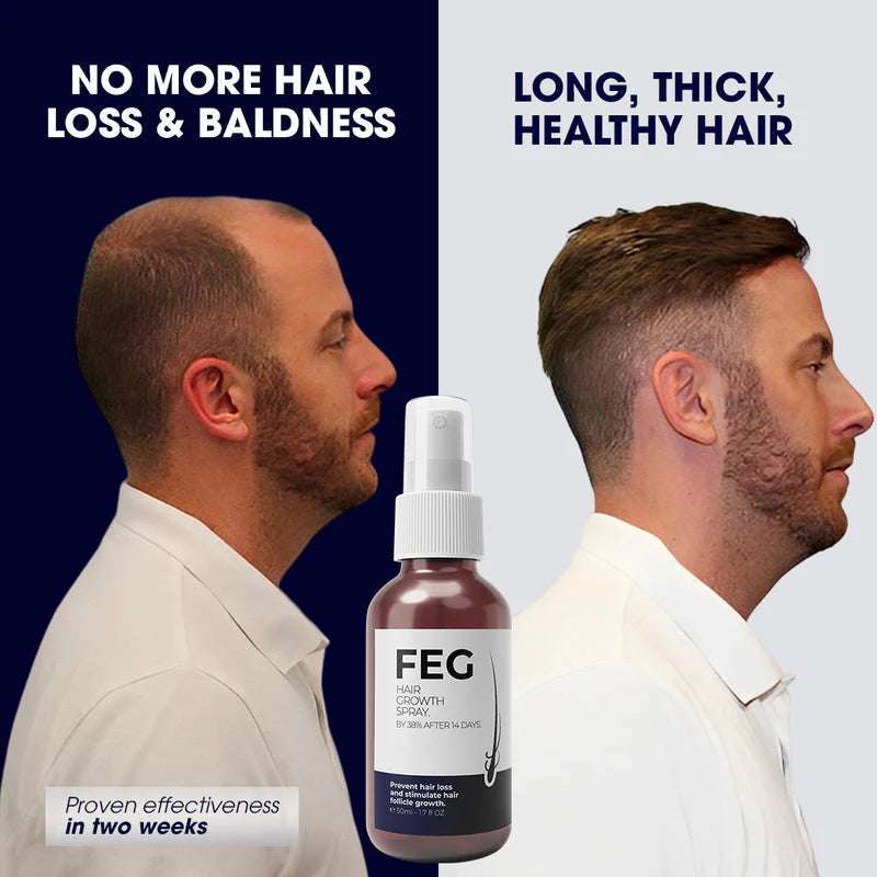 FEG Plus Beard & Hair Growth Serum Spray | 60 ML - Link Lift Shop