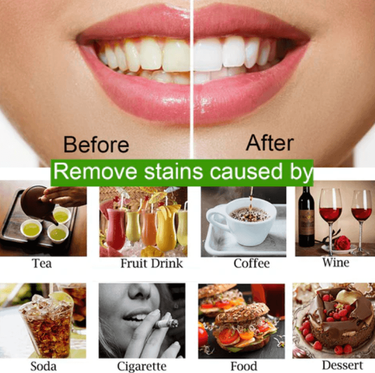 Mad Smile Teeth Cleaning Powder (organic) White (30g) - Link Lift Shop