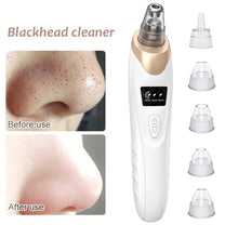 Derma Suction Facial Pore Cleanser - Blackhead Whitehead Remover Suction Machine - Link Lift Shop
