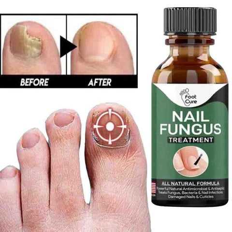 Nail Fungus Serum (MADE IN USA) - Link Lift Shop
