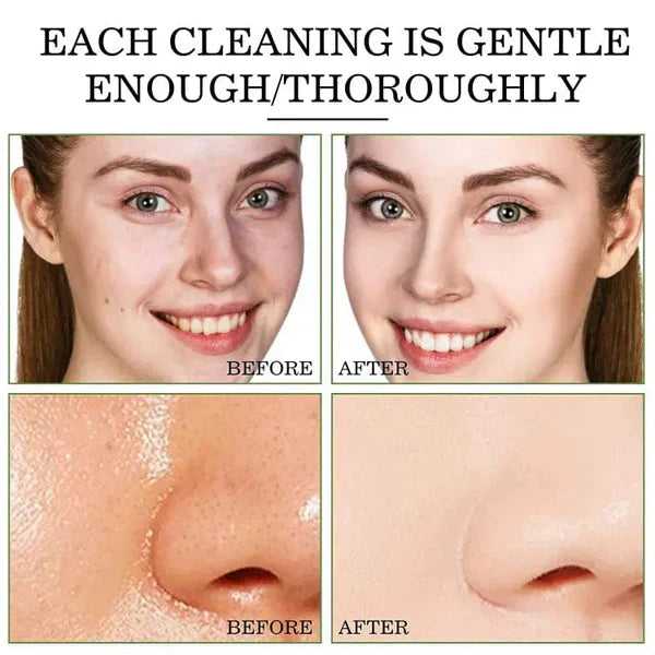 Green Tea Stick Mask for Deep Cleansing and Pore Care | Hydrating Face Masks for Acne and Blackheads - Link Lift Shop