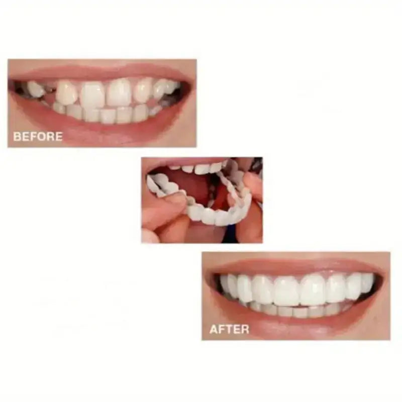 SNAP ON SMILE - Link Lift Shop